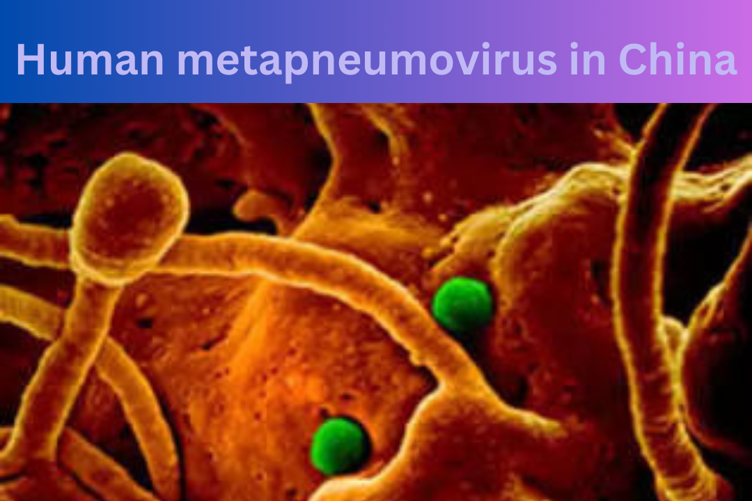 Human metapneumovirus hmpv china